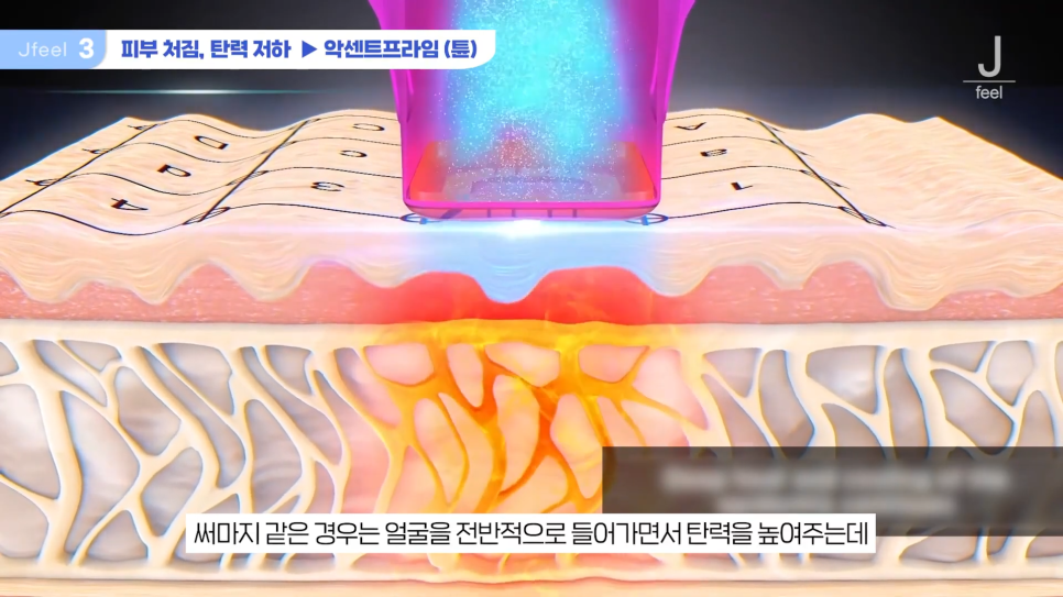 3O대피부과시술 3가지 추천 관련 이미지 7