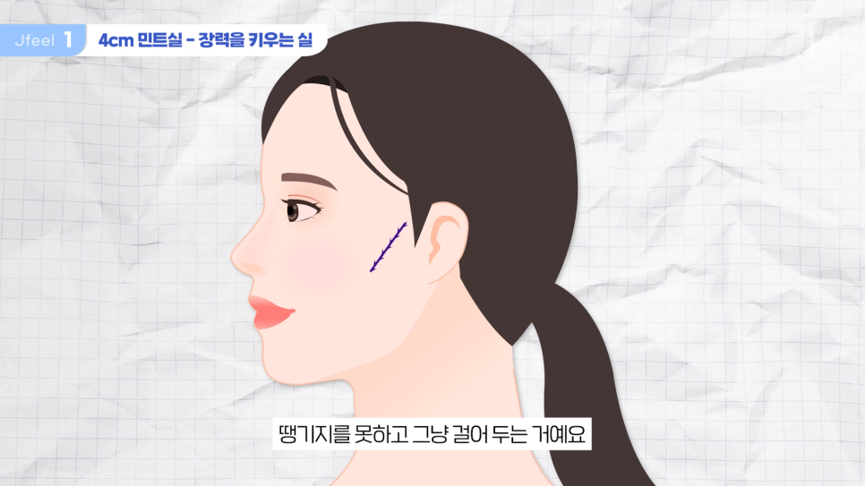 민트실을 돼지고기에 넣는다면? 실리프팅 실험 관련 이미지 5