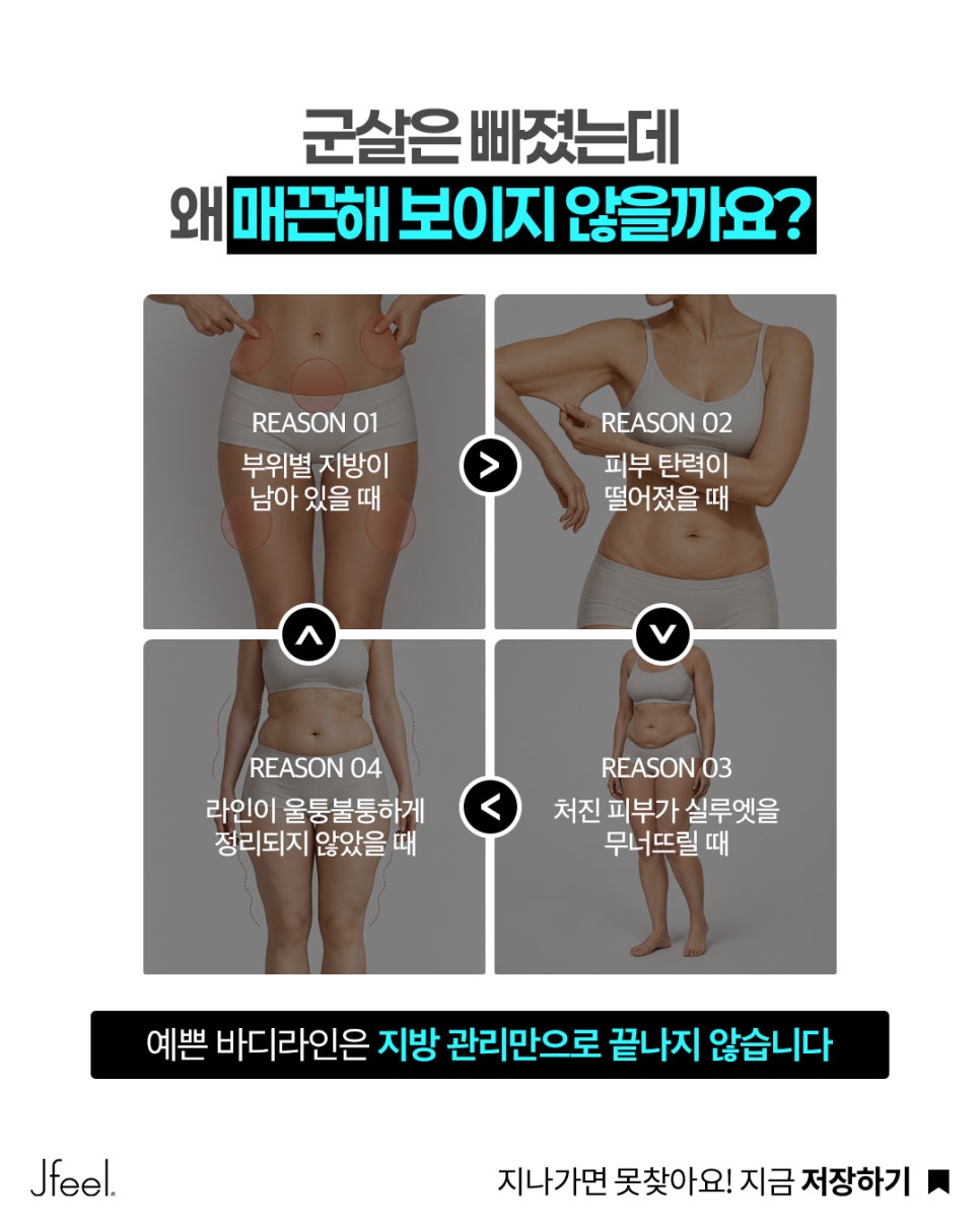 다이어트 후에도 안 빠지는 군살? 지방분해주사·바디온다로 알아보는 바디라인 관리 관련 이미지 5