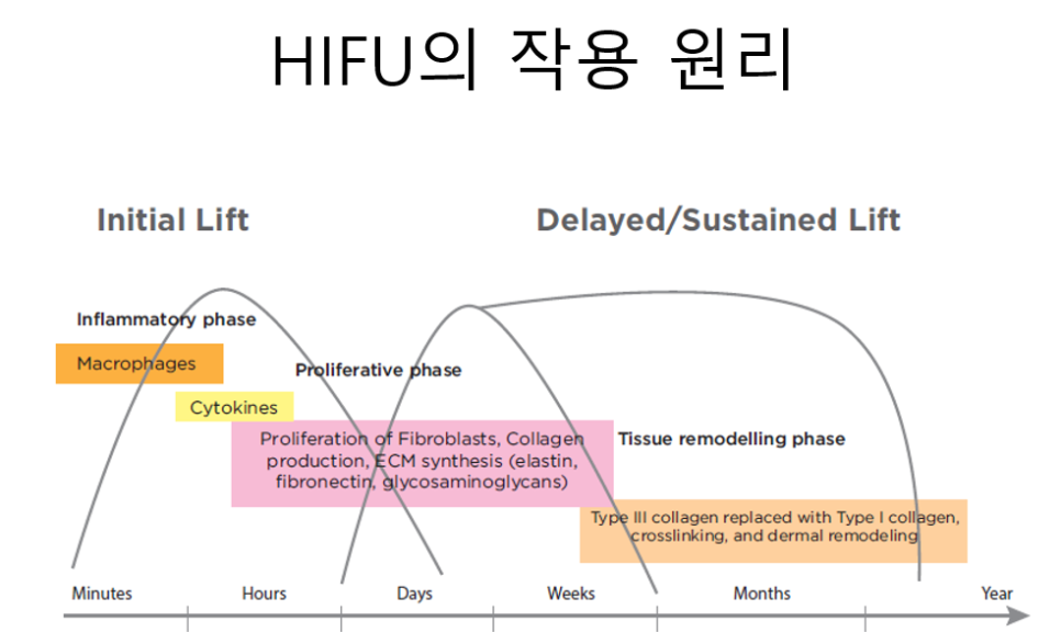 [홍대피부과] 제이필의원의 슈링크 vs. 울쎄라 그 차이에 대한 고찰 관련 이미지 3