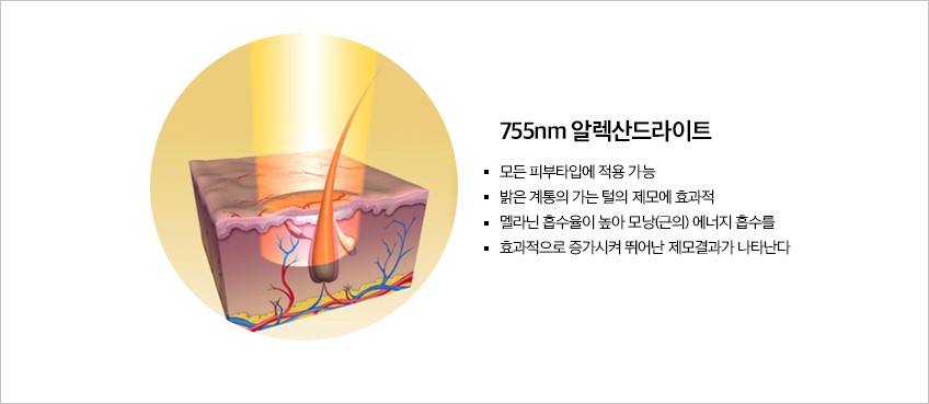[홍대피부과] 여름 준비 시작은 제모. 홍대 아포지 레이저 제모 관련 이미지 2
