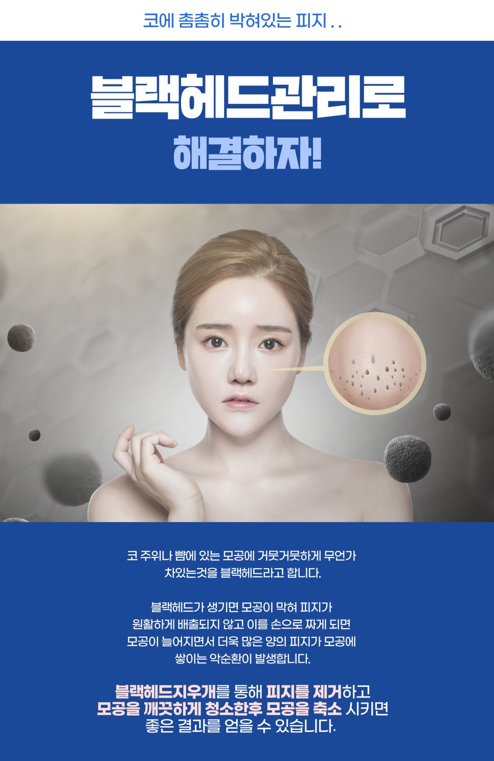 블랙헤드관리, 모공 속 피지 관리가 우선 관련 이미지 4