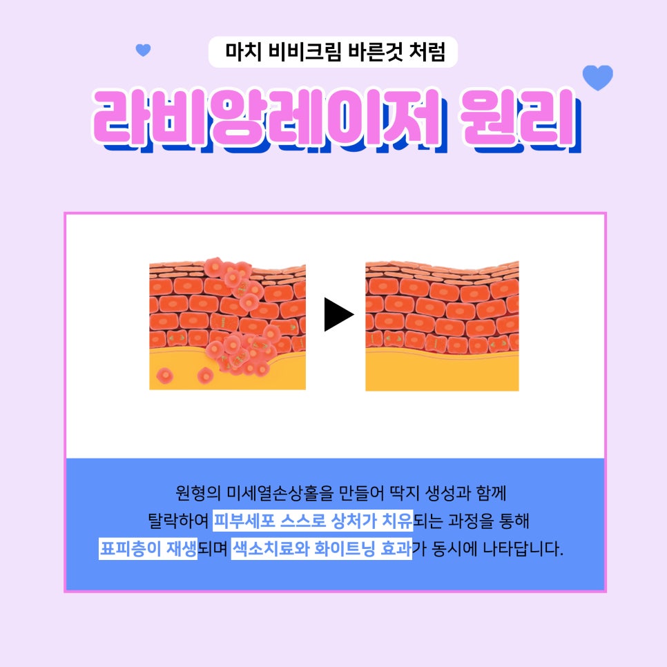맑고 투명한 무결점 패키지로 파데FREE 가능! 관련 이미지 3