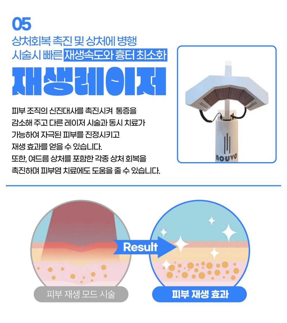 얼굴잡티관리, 원데이 잡티지우개로 확실하게 관련 이미지 7