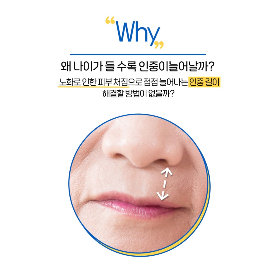 노화로 인해 늘어난 인중! 비수술 인중축소술로 개선해요 관련 이미지 2