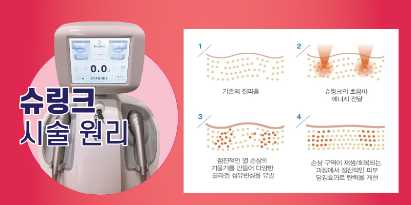 [홍대 피부과] 제이필의원에서 리프팅 묻고 V라인까지 더블로 가! V라인 듀얼 땡김이 리프팅 관련 이미지 3
