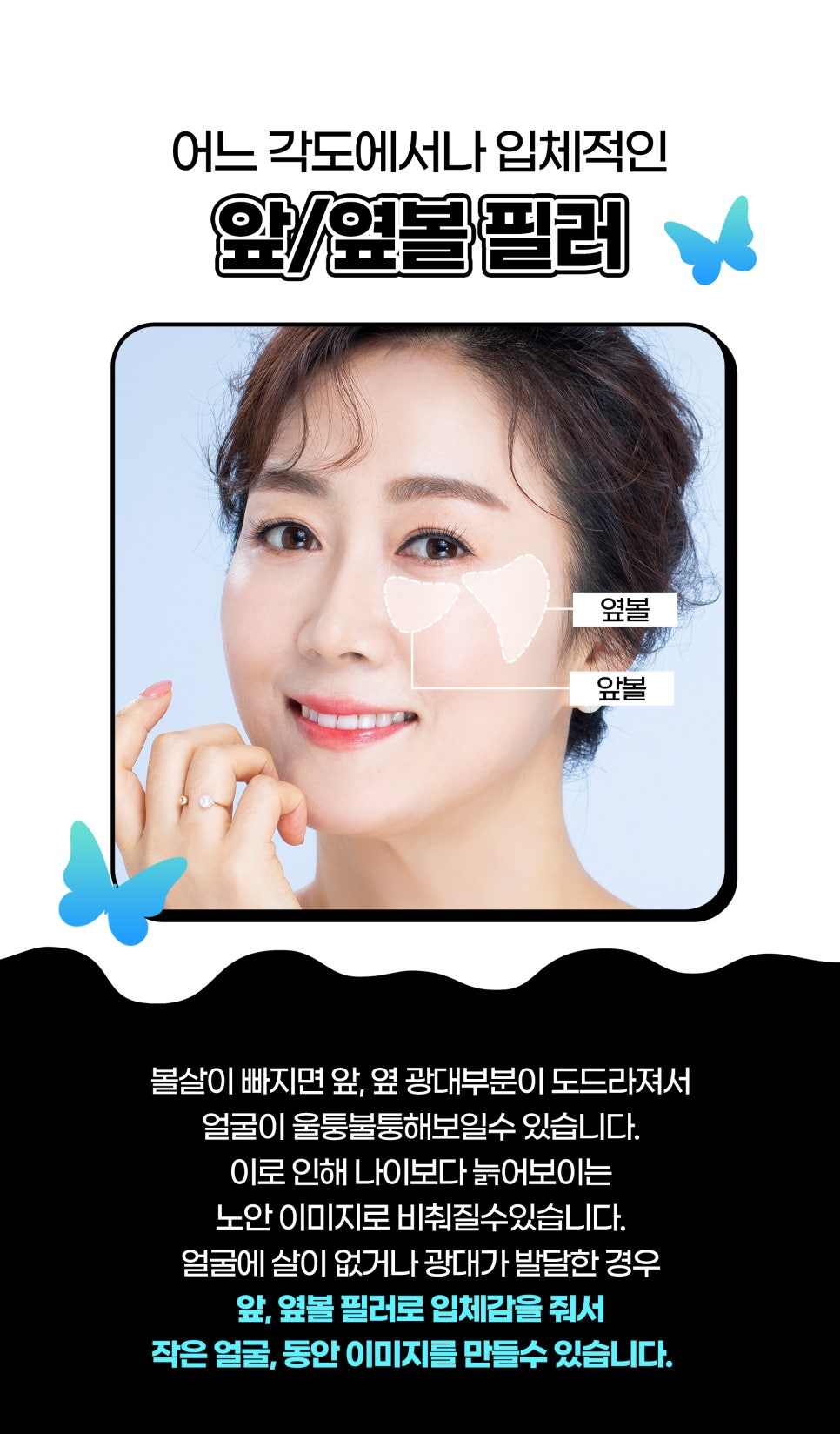 동안필러로 볼륨감 만드는 방법 관련 이미지 3
