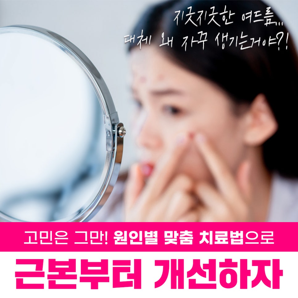 여드름과 흉터 개선에 도움을 주는 치료 방법 관련 이미지 4