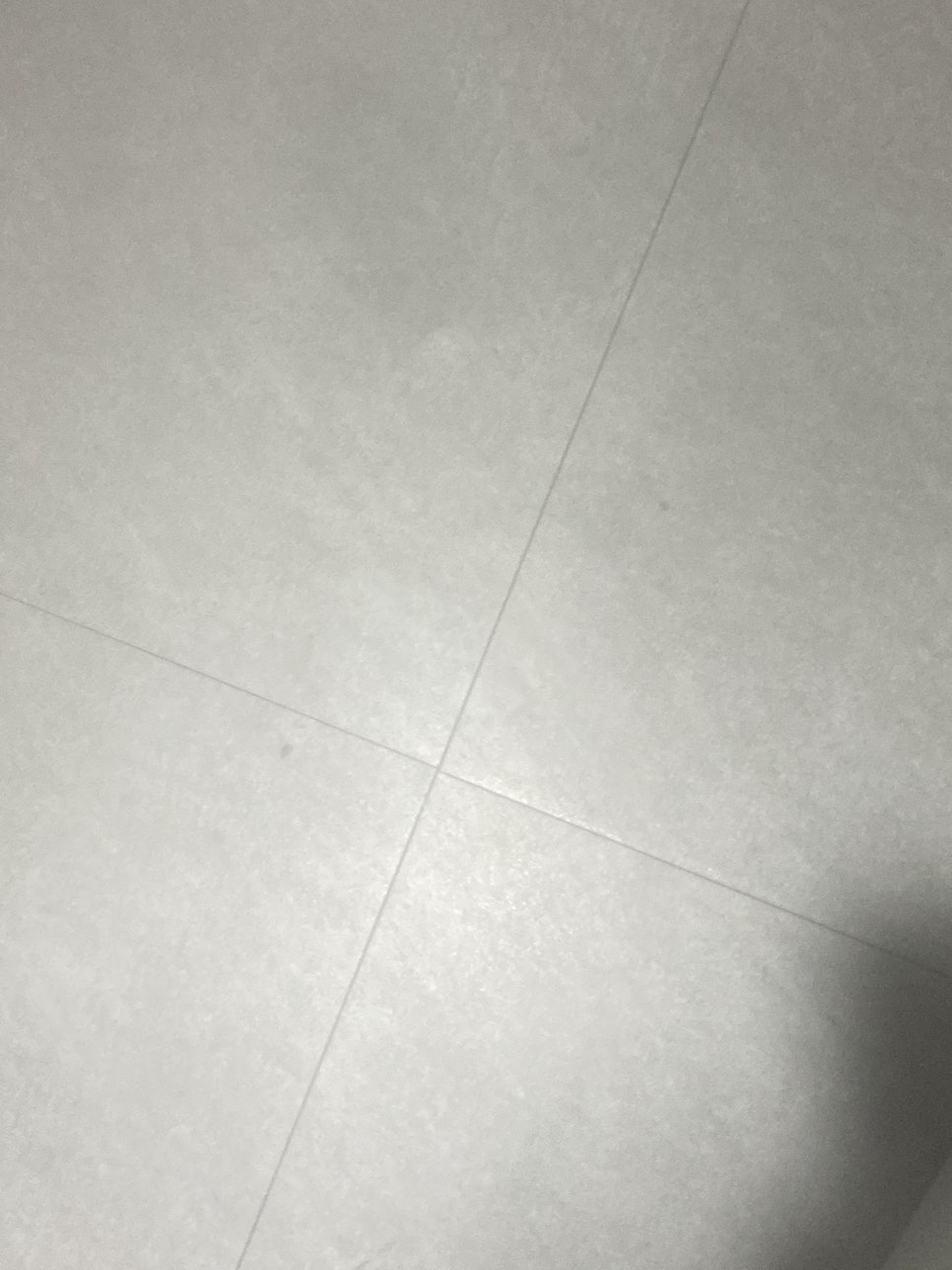 기미잡티레이저 파이브색소레이저+앰플관리로 꾸준히 관리하기 관련 이미지 10