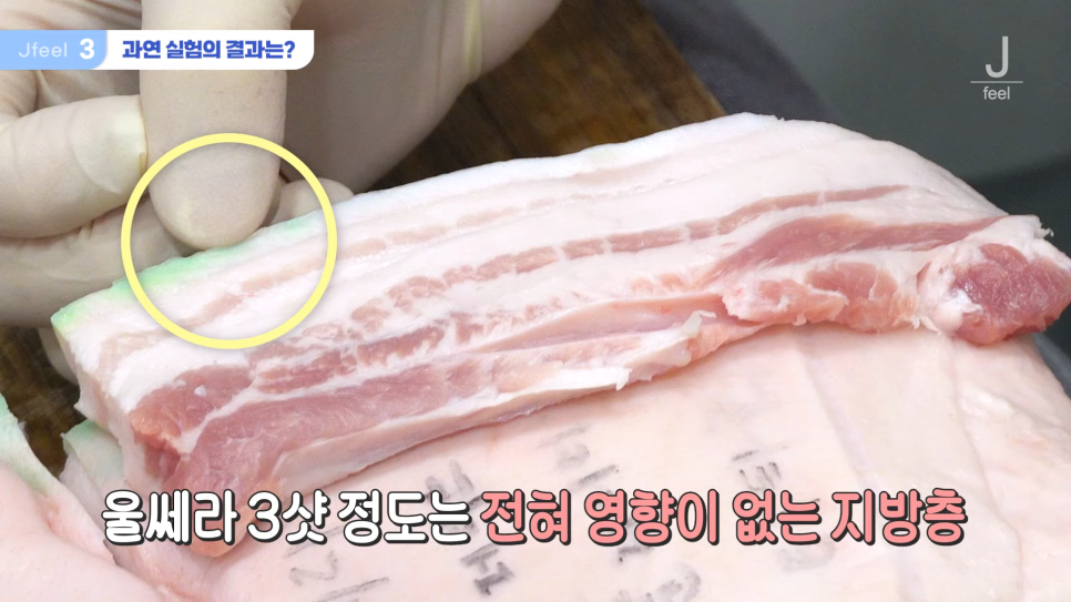 지방레이저가 얼굴 지방을 얼마나 녹일 수 있을까? 관련 이미지 7