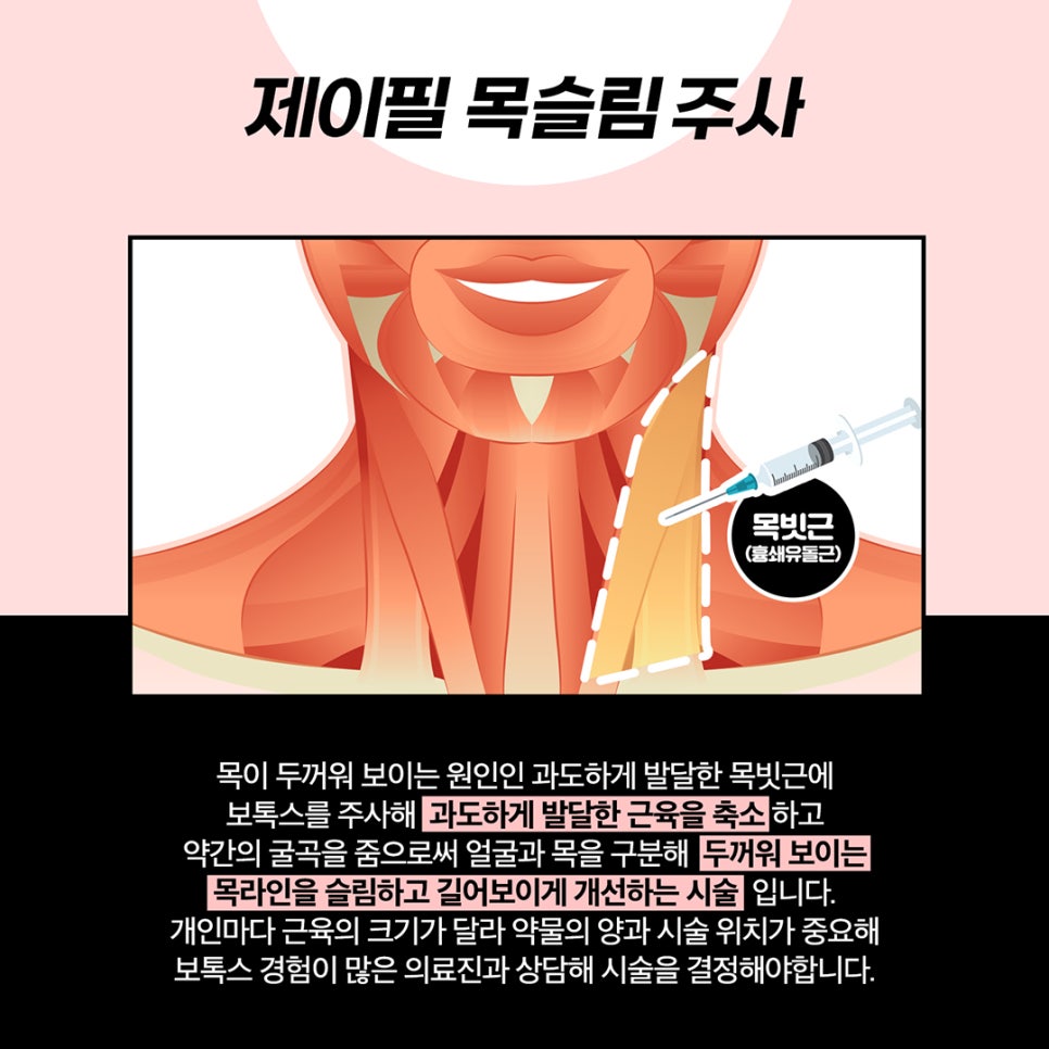 팔뚝, 어깨라인을 한번에 지방흡입한듯 여리하게 만들고싶다면? 관련 이미지 4