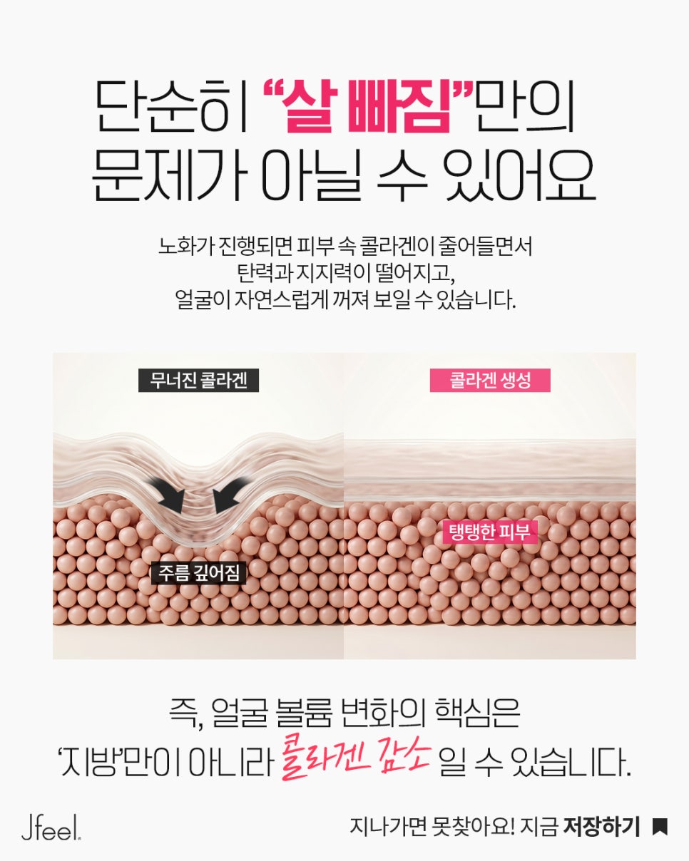 볼·관자·팔자 꺼짐, 얼굴살 빠진 게 아니라 콜라겐 감소일 수 있습니다|스컬트라 관련 이미지 3