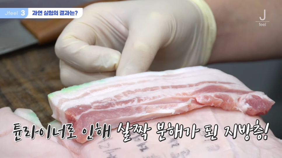 지방레이저가 얼굴 지방을 얼마나 녹일 수 있을까? 관련 이미지 9