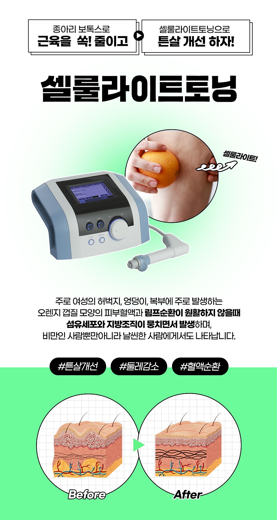 종아리알 유형별로 매끈하게 관리하기 관련 이미지 5
