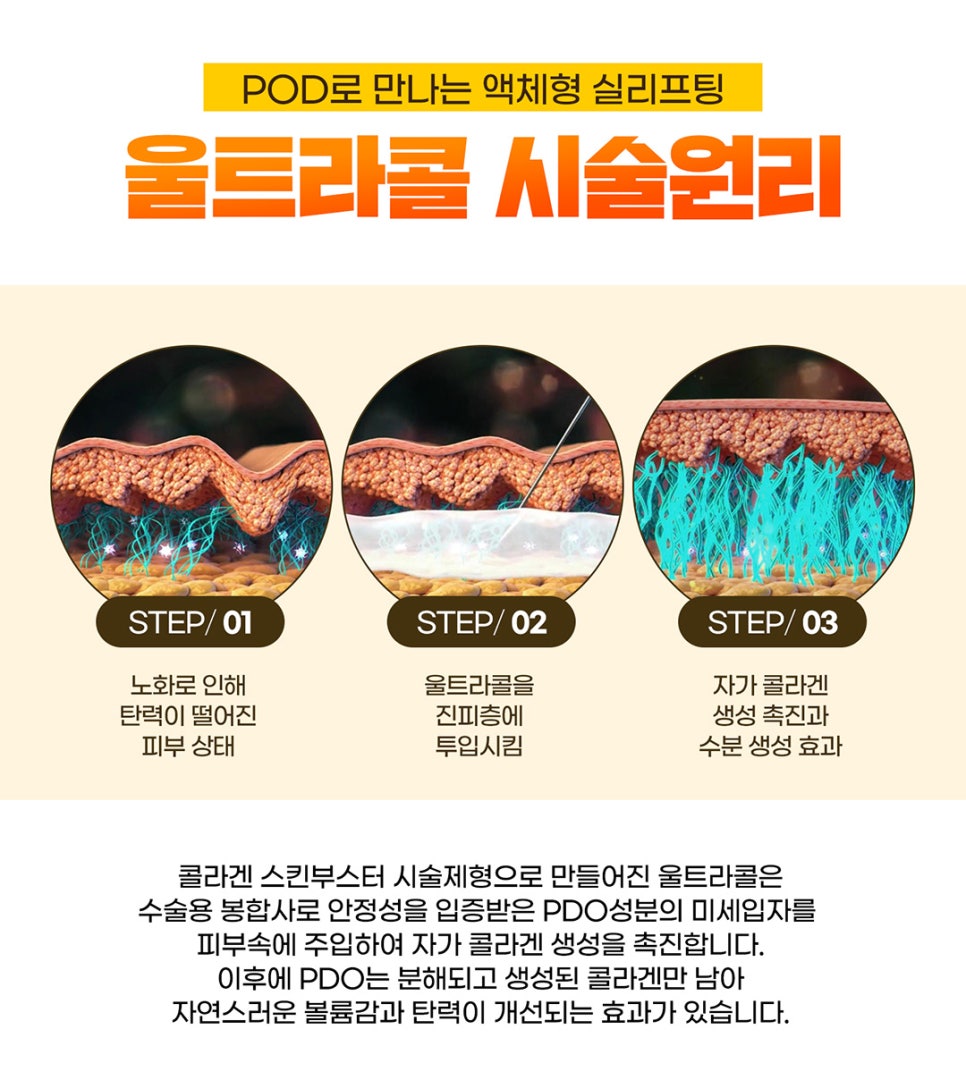 울트라콜로 부작용 걱정없이 피부탄력 채우자 관련 이미지 7