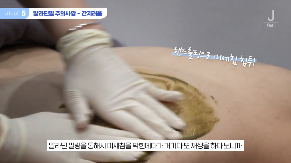 등여드름필링으로 연예인 등 만들기 관련 이미지 19