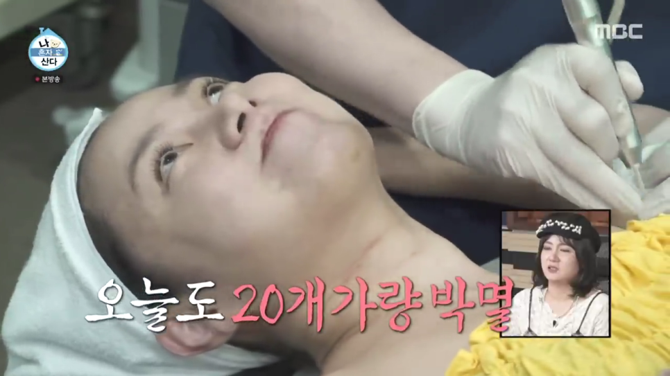 나혼산 박나래 쥐젖제거 홍대 쥐젖 피부과 얼굴 목 쥐젖 제거 비용 관련 이미지 9