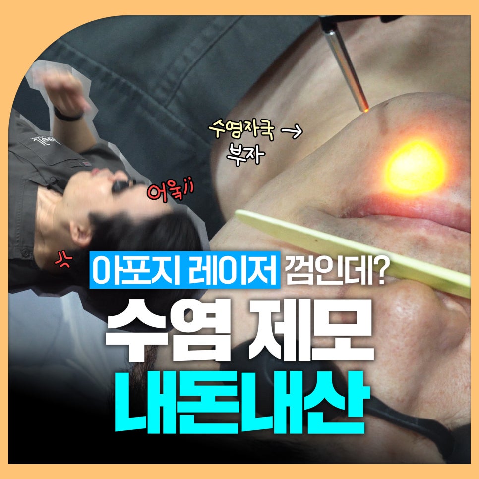 수염 레이저 제모 원장님 직접 리뷰 관련 이미지 1
