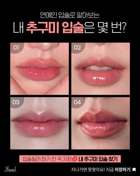 입술필러 후기부터 가격·붓기까지! 요즘 유행하는 입술확장 필러는 뭐가 다를까? 관련 이미지 4