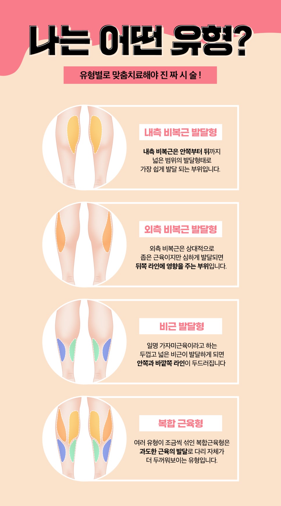 종아리라인, 바디톡스로 매끈한 인형 다리 만들기 관련 이미지 4