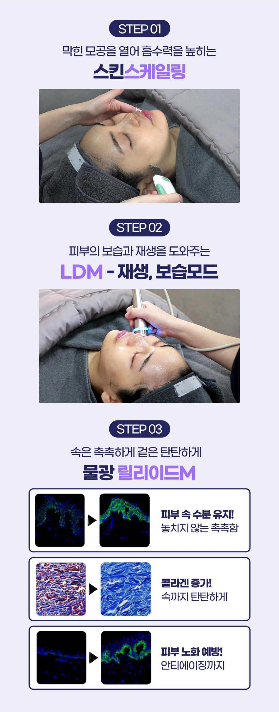 봄피부관리, 차세대 물광주사로 촉촉 탱글 하게 관련 이미지 6