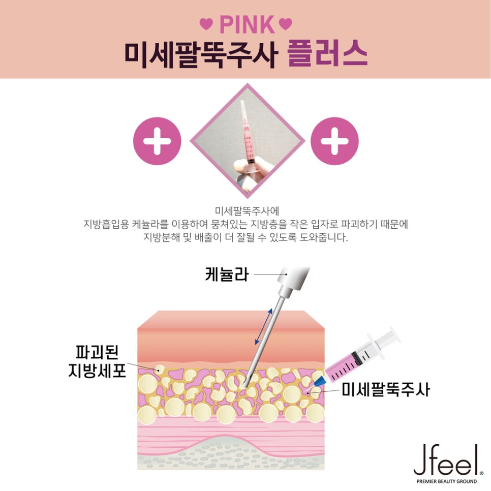 [홍대피부과]  미세팔뚝주사로 날씬한 팔뚝 만들기 관련 이미지 6