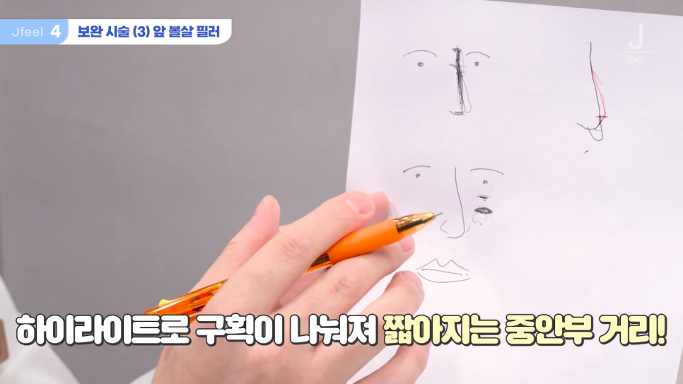 긴중안부를 커버할 수 있는 방법? 초간단 3가지! 관련 이미지 15