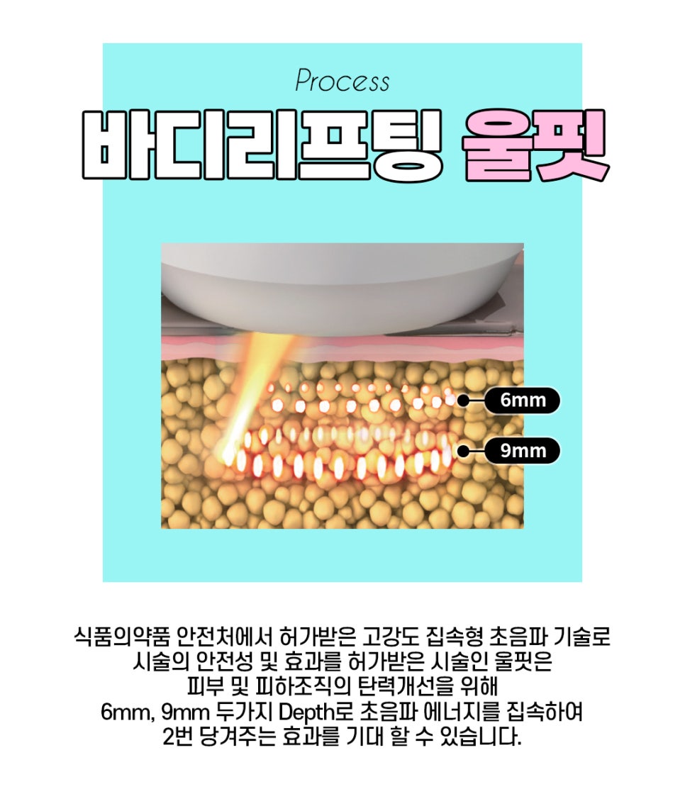 바디관리, 바디인모드와 울핏의 조합으로 관련 이미지 5
