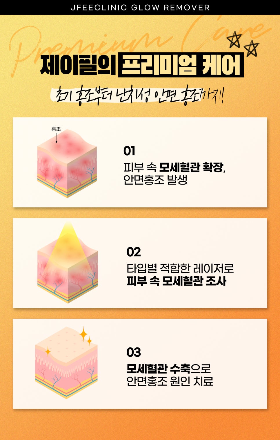 홍조없애기, 홍조레이저와 크라이오셀 관련 이미지 4