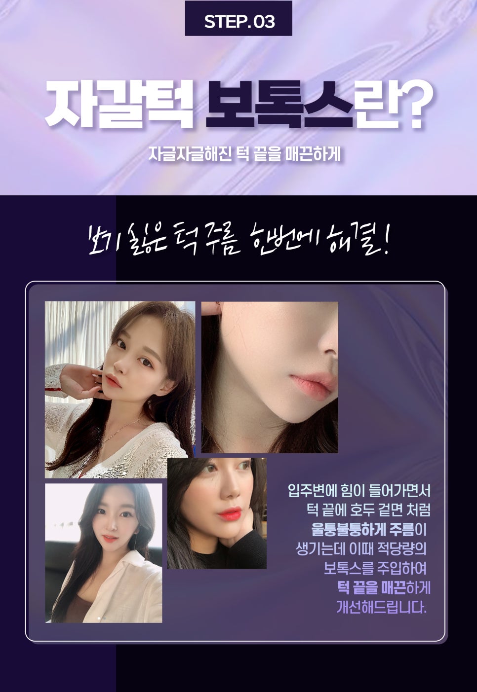 브이라인 턱라인 만들고 싶다면? 관련 이미지 5