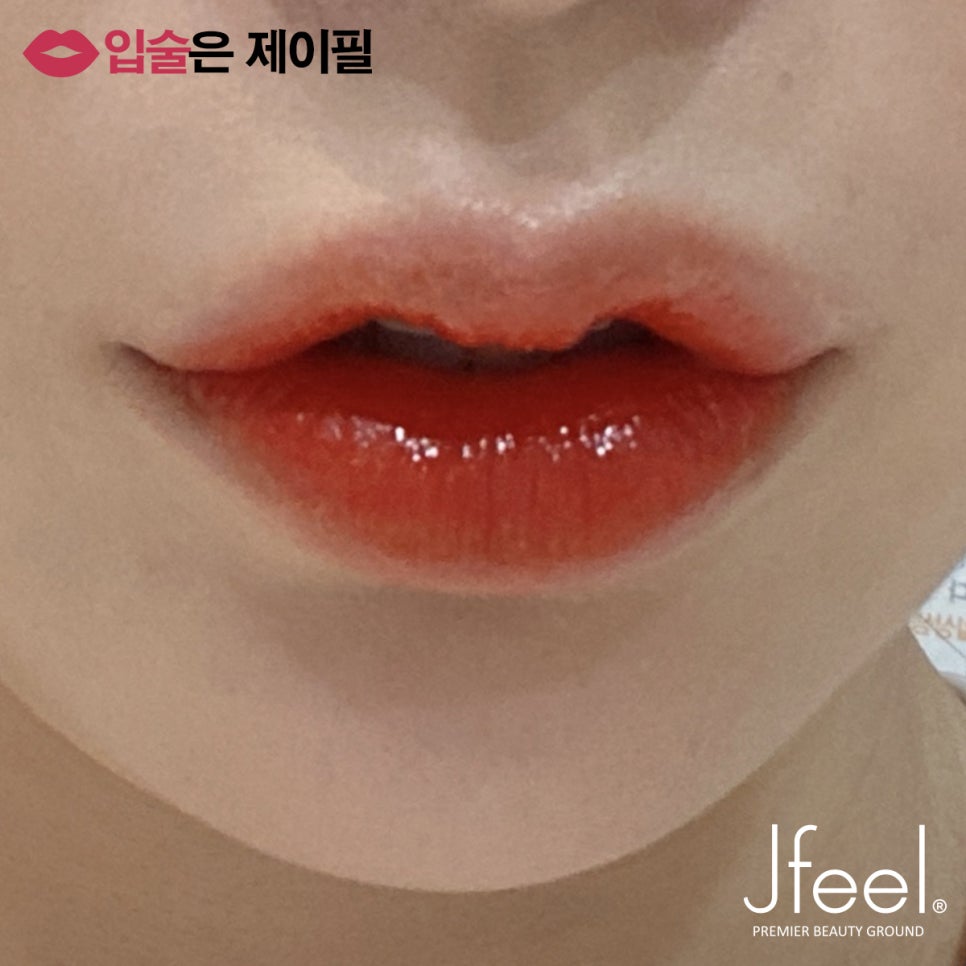 입술필러 유지기간 얼마나 되나요? 관련 이미지 5