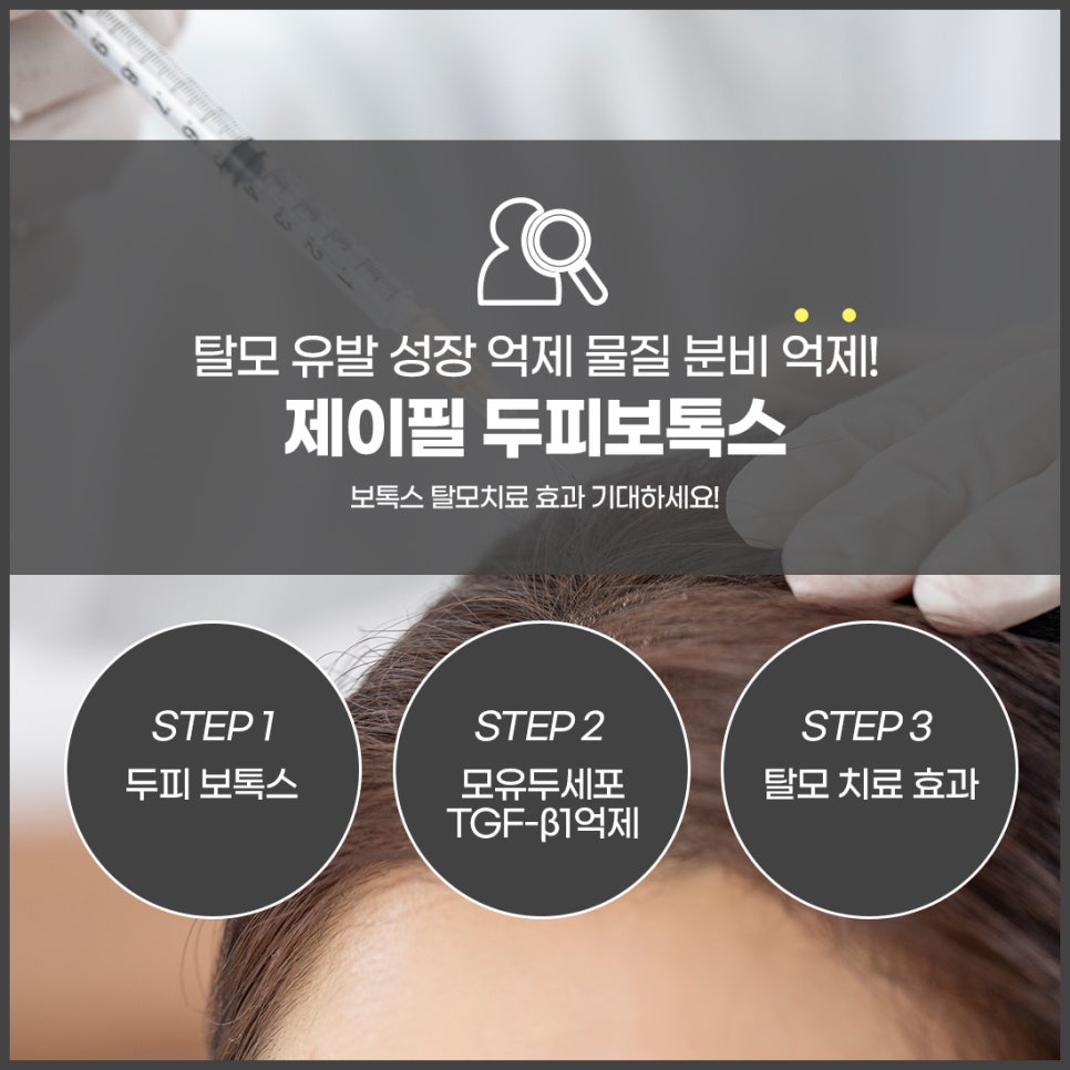 홍대두피 탈모보톡스로 고민 해결 관련 이미지 3