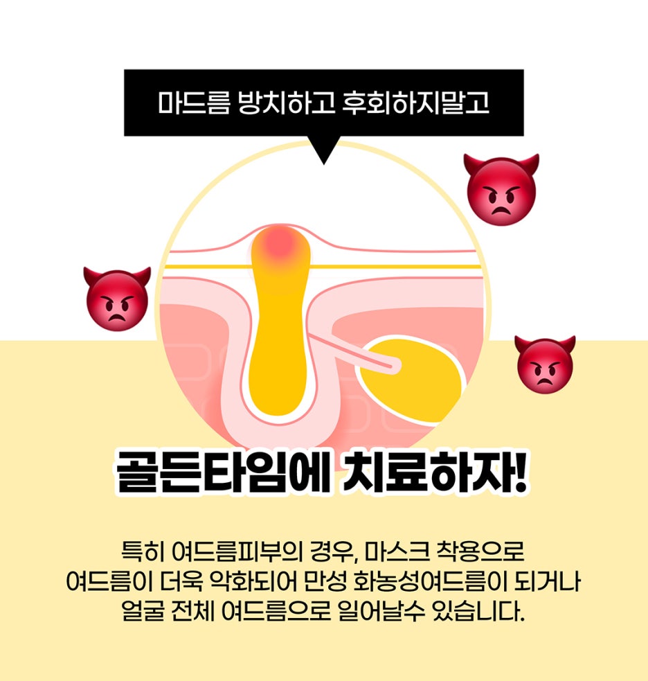 마드름 끝장내기? 제이필 마그네스 이벤트로! 관련 이미지 2