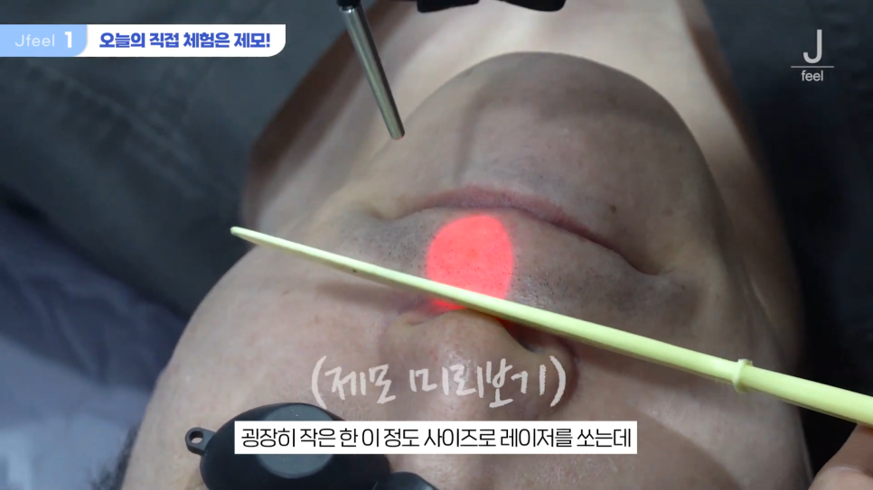 수염 레이저 제모 원장님 직접 리뷰 관련 이미지 3