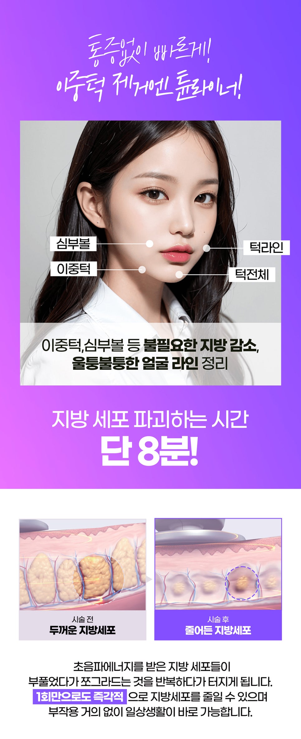 얼굴지방 파괴는 튠인모드 관련 이미지 4