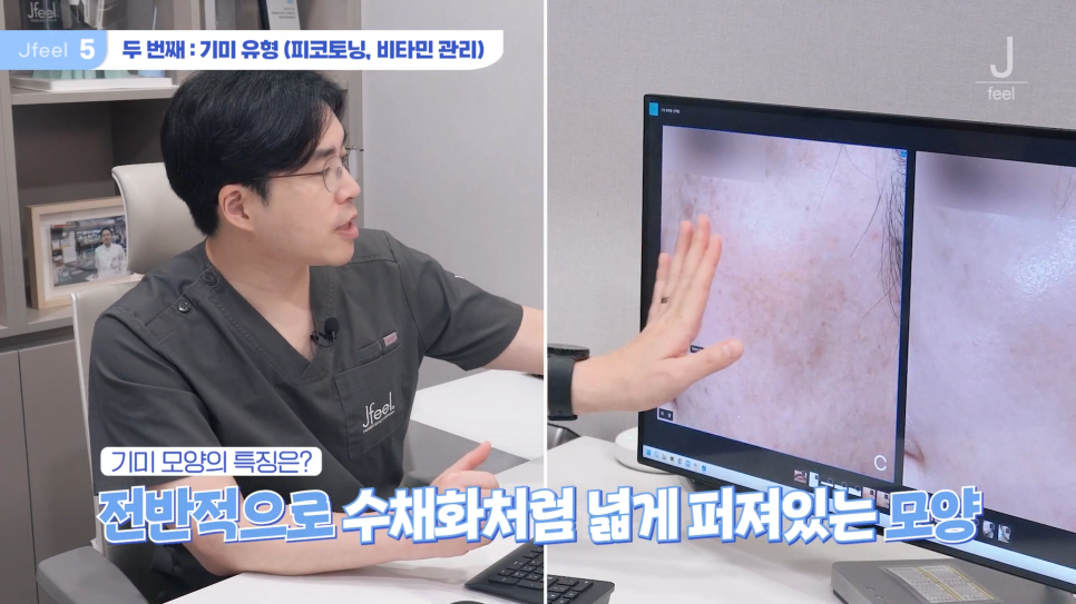 기미 주근깨 잡티에 이 시술만은 NO! 시술 전 필독 관련 이미지 10