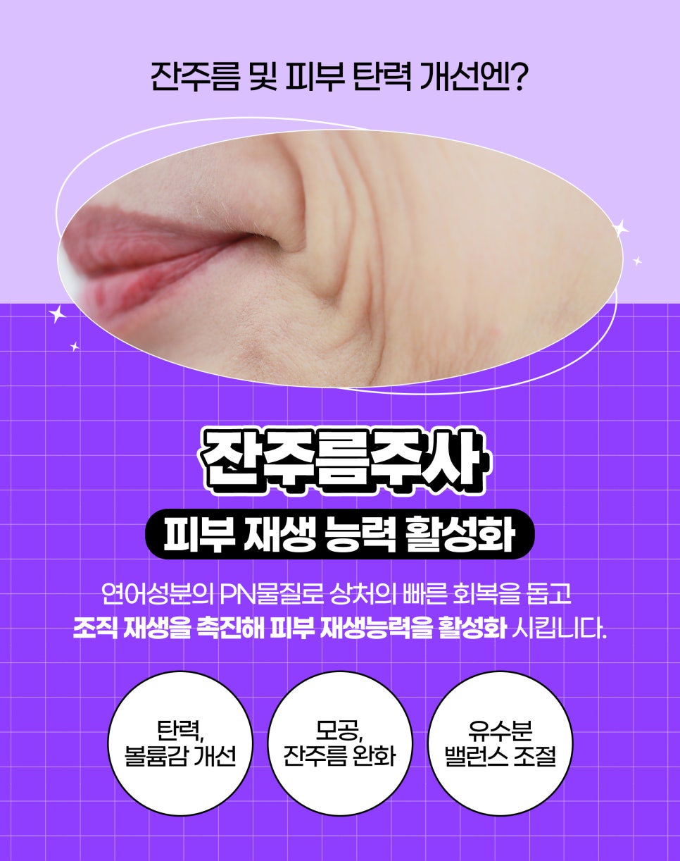 팔자주름없애는방법, 제이필 팽팽팔자주름으로 해결 관련 이미지 5