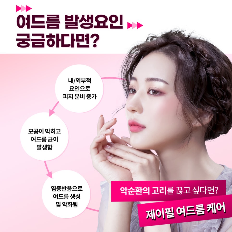 여드름과 흉터 개선에 도움을 주는 치료 방법 관련 이미지 5