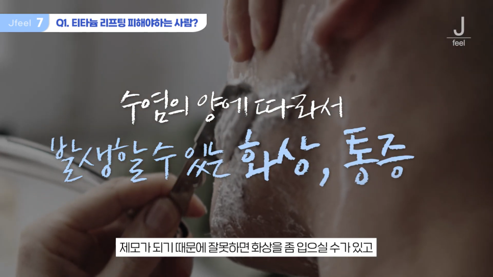 연예인리프팅, 티타늄리프팅으로 갈아탄 이유와 Q&A 관련 이미지 10