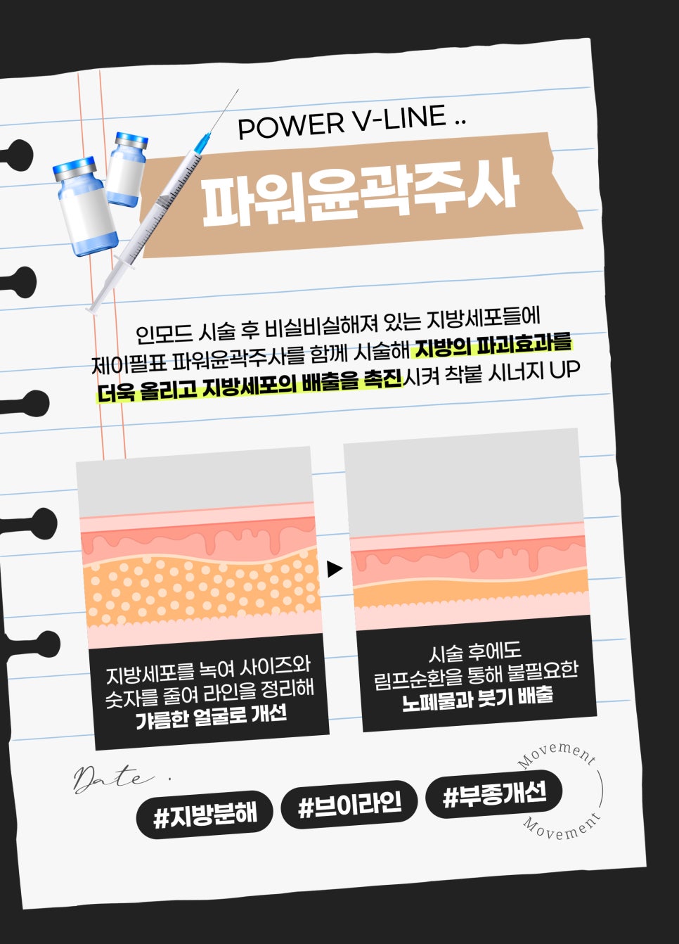 얼굴라인정리, 트리플 착붙인모드로 한 번에 관련 이미지 7