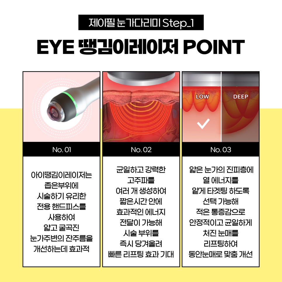 눈가관리, 무통증 눈가다리미로 해결 관련 이미지 3