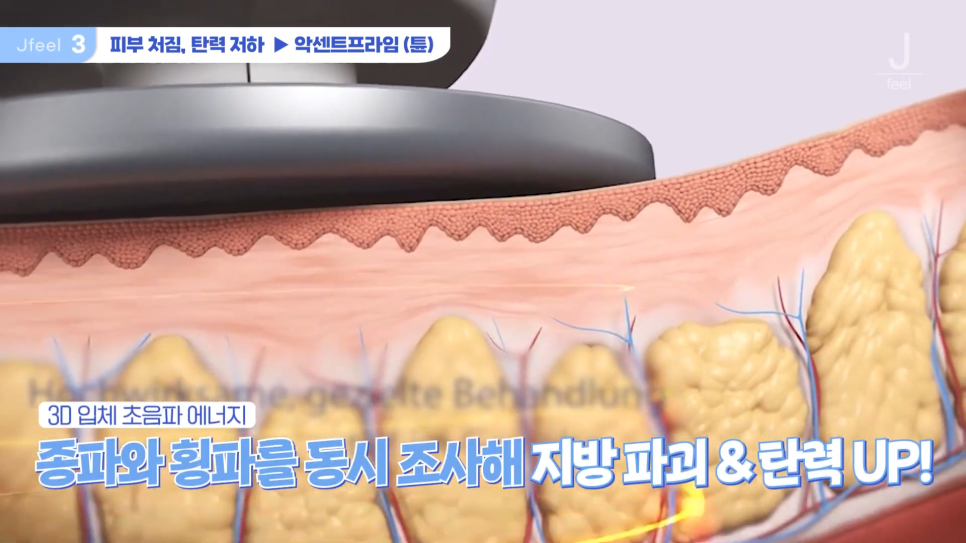 3O대피부과시술 3가지 추천 관련 이미지 11
