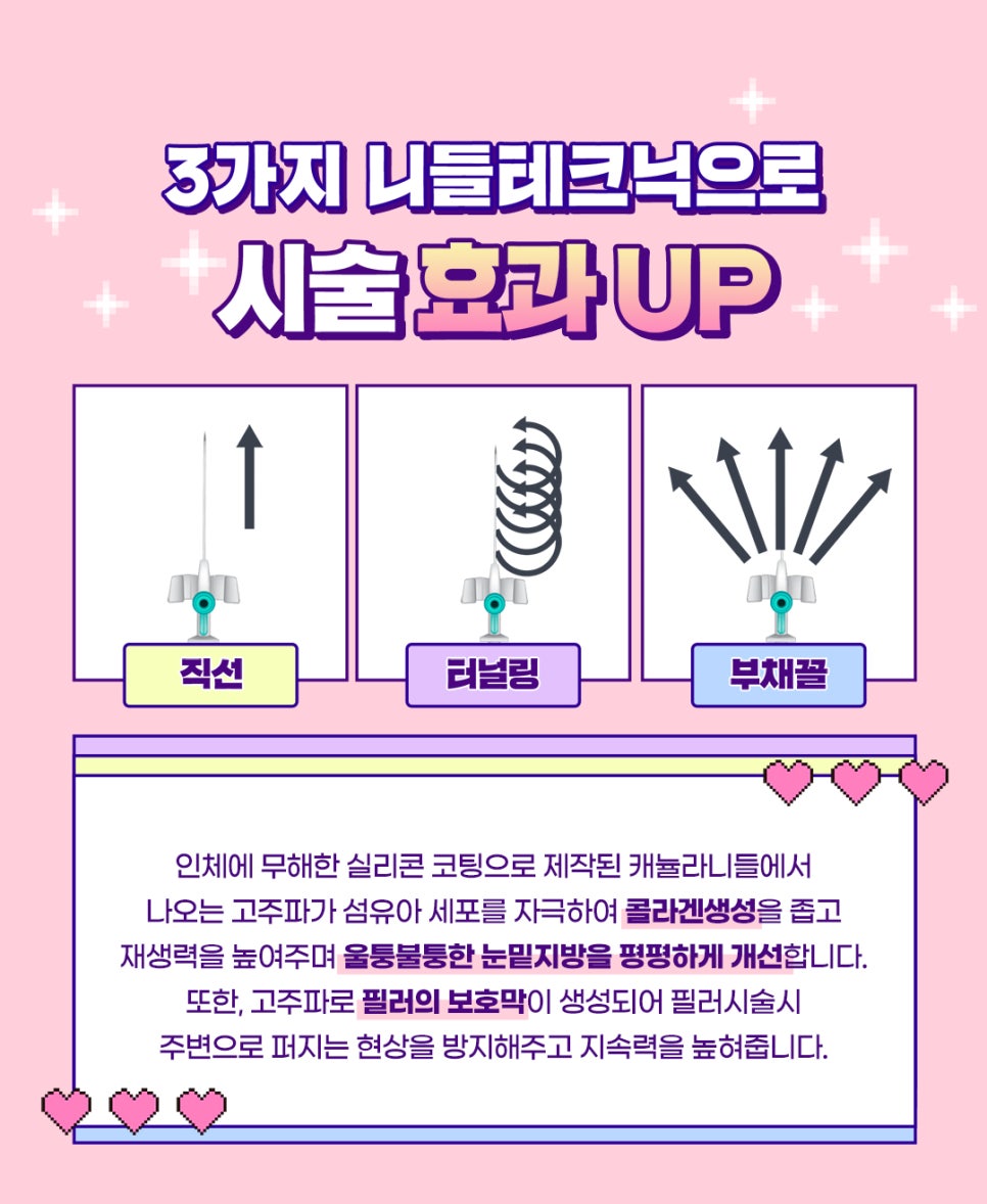 눈밑지방재배치 수술 말고 레이저로 간단하게! 관련 이미지 4