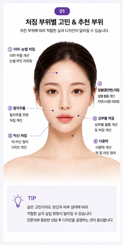 실리프팅 종류가 너무 많아요, 저는 뭘 해야 하나요?｜민트실&middot;잼버실&middot;실루엣소프트 비교 관련 이미지 18