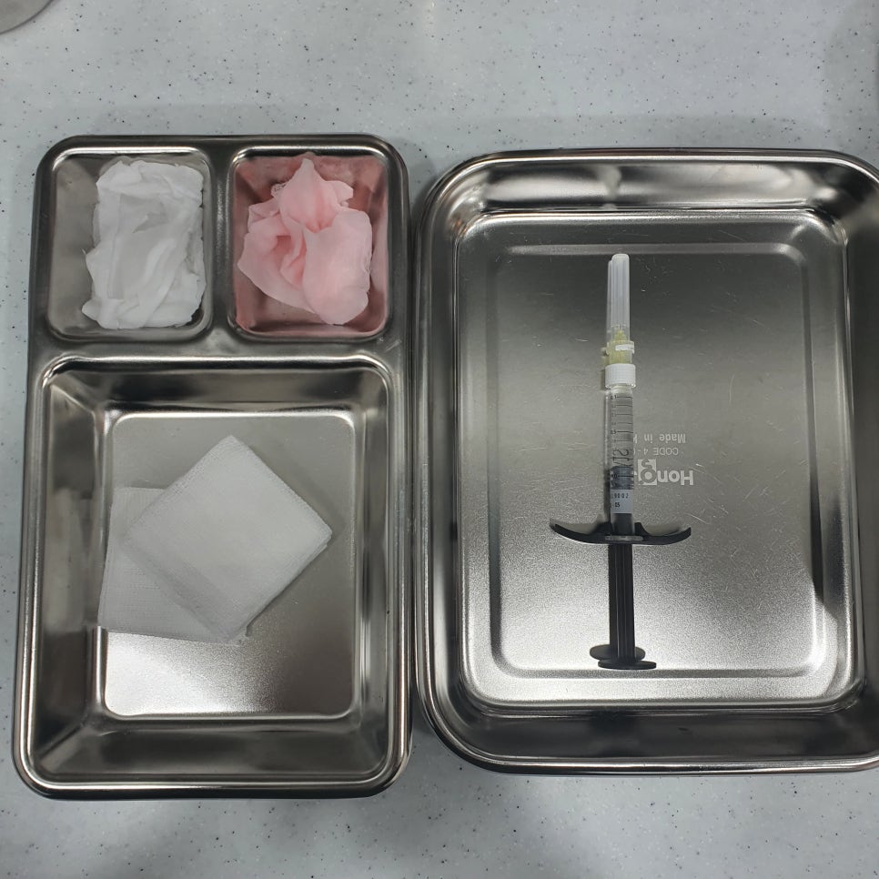입술필러 맞고 조심해야 할 점, 주의사항, 통증, 붓기 관련 이미지 3
