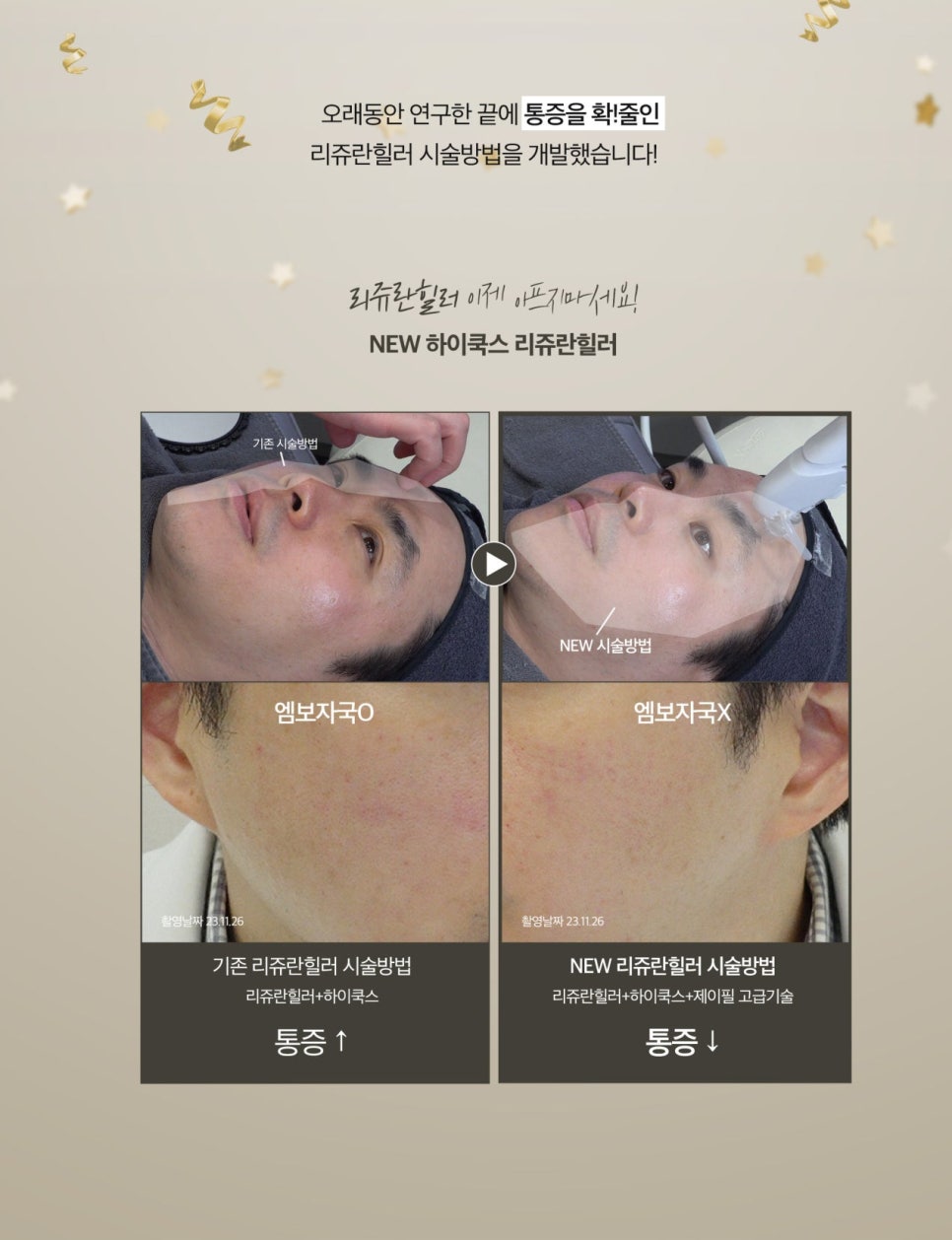 2026 New Year, Now Is the Chance! Upgrade Your Skin with Jfeel Clinic image 8