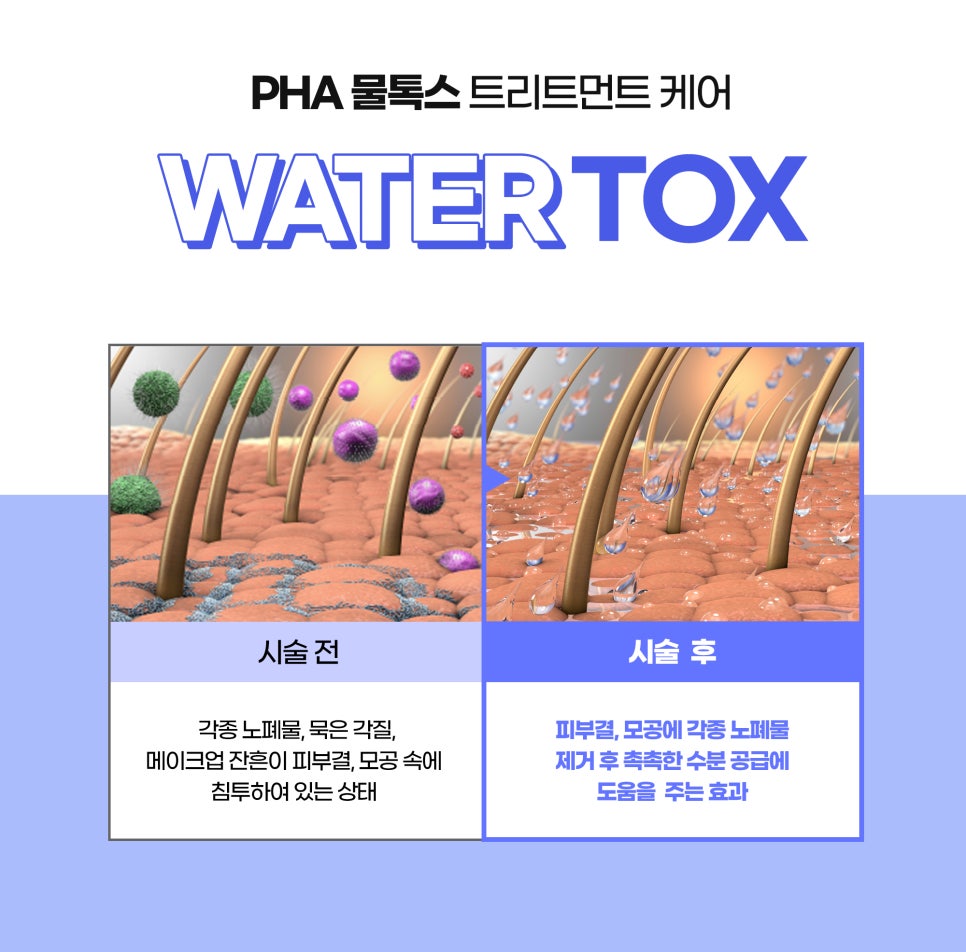 건조한피부를 촉촉하게! 물광창조로 관련 이미지 7