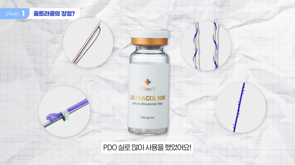 필러가 싫다면? 눈가, 팔자, 주름 해결하는 울트라콜 관련 이미지 3