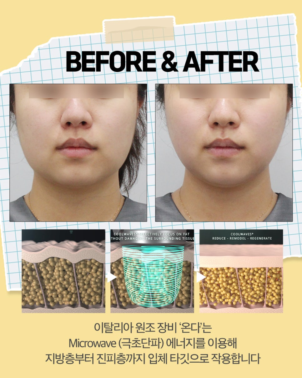[강남 피부과] 2월 특가 새해 특별 이벤트, 연휴 피부관리 추천 관련 이미지 10