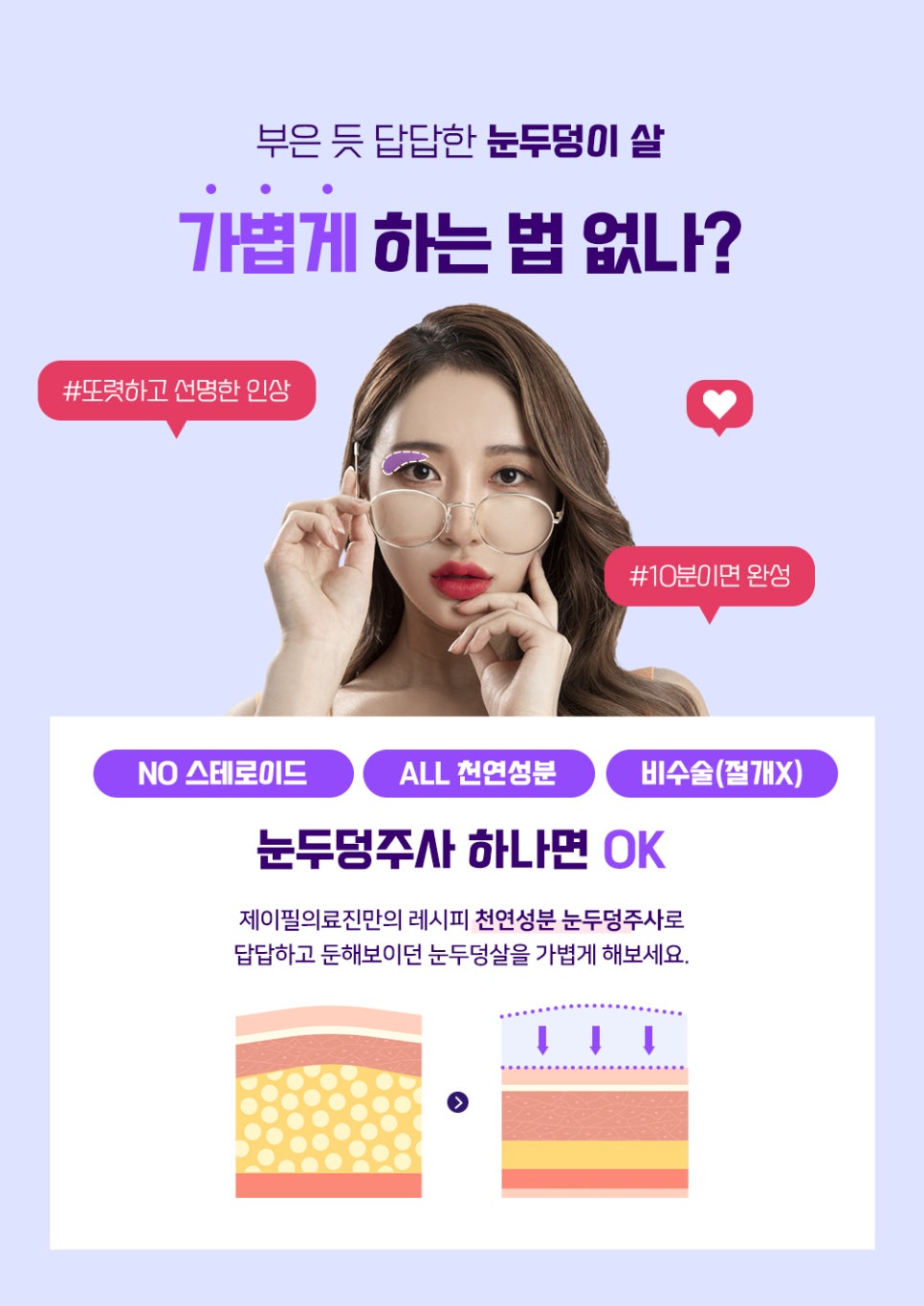 무거운 눈지방을 주사로 제거가 가능하다면? 관련 이미지 2